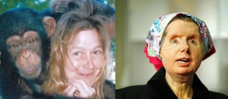 woman whose face got eaten by chimp