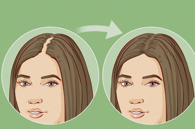 Regrowing hair can depend on various factors