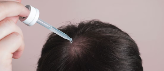 Hair loss can be distressing