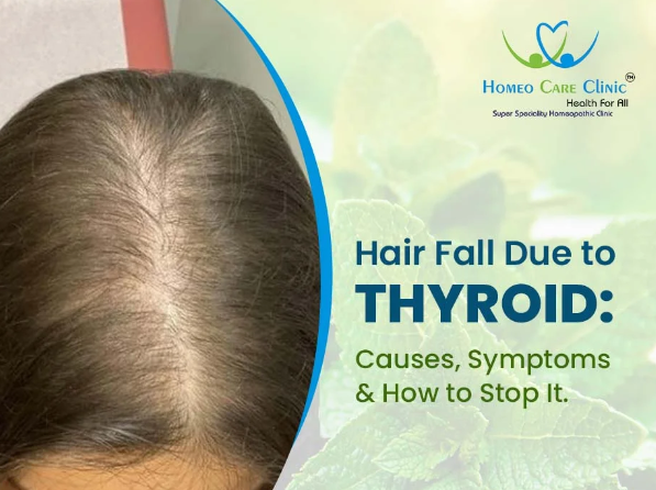 Thyroid-related hair loss