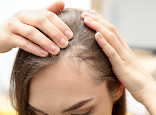 Thinning hair can be caused by various factors