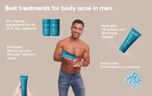 How Men Can Prevent Body Acne Through Cleansing