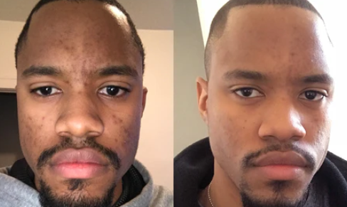 How Men Can Cleanse Skin for a Smoother Appearance