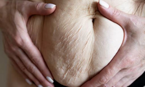 Postpartum Skin Changes Explained
