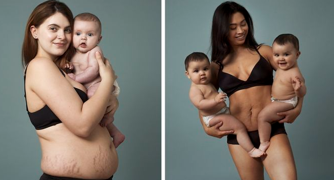 Postpartum Body Care Mistakes