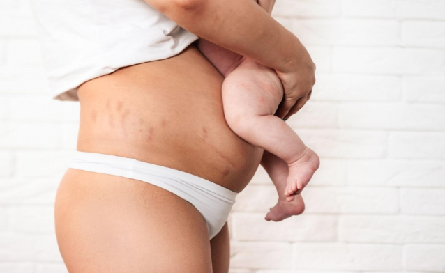 Postpartum Thigh Care Tips
